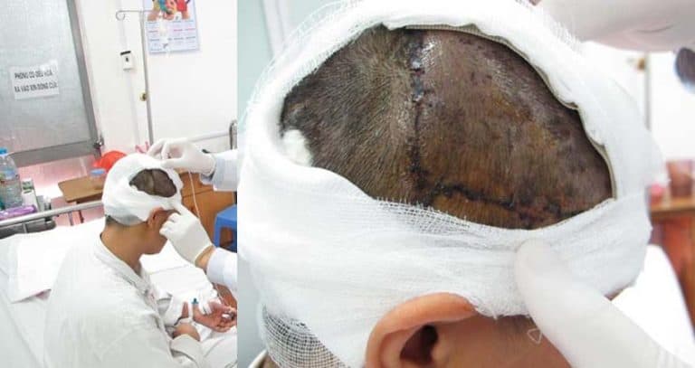 Sử Dụng Mũ Bao Tóc Đề Phòng Tai Nạn Cuốn Tóc Lao Động Nữ